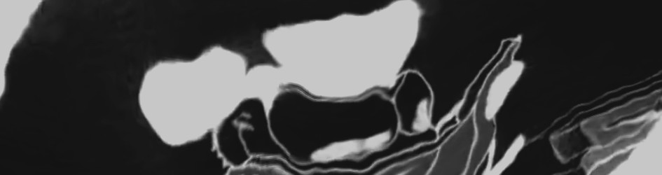 Green Velvet - The Stalker (Stoid's Tribute)